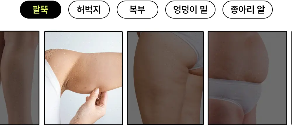 [NEW] 닥터빼 셀룰라이트 랩핑 패치 9g * 12ea 상세페이지 13